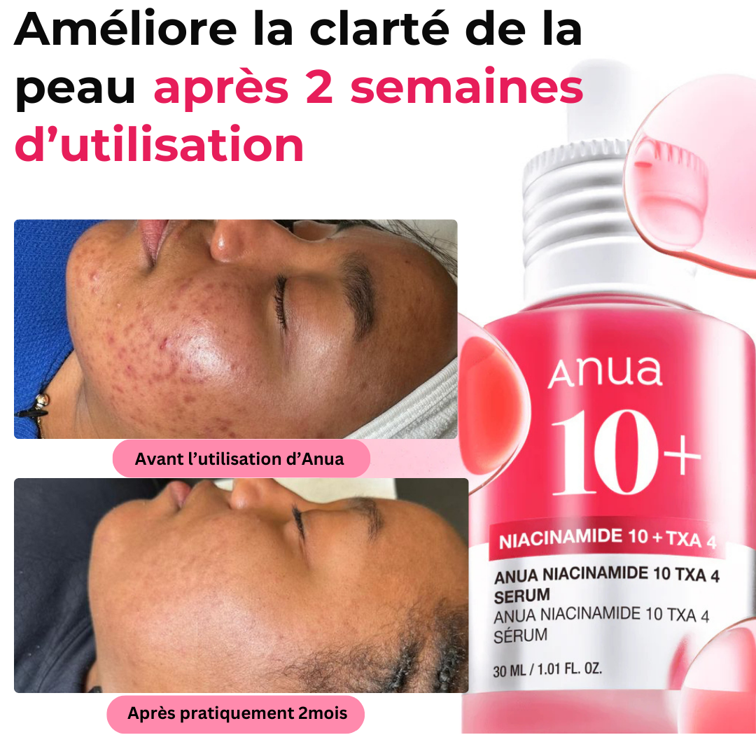 Serum Anua 10% de Niacinamide et 4% d'acide Tranexamique